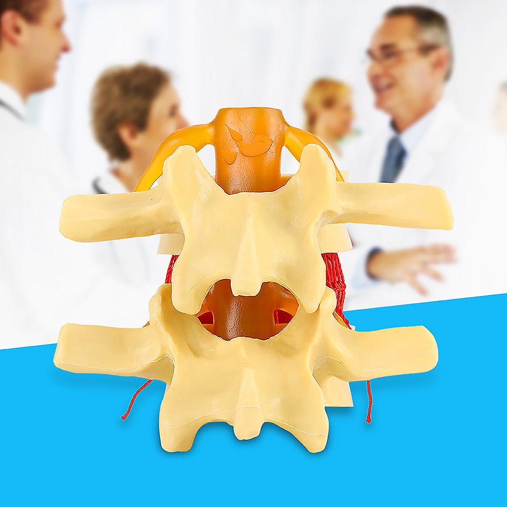 1:1.5 Anatomical Medical Human Spine Lumbar Disc Herniation Demonstration Model For Study Learn