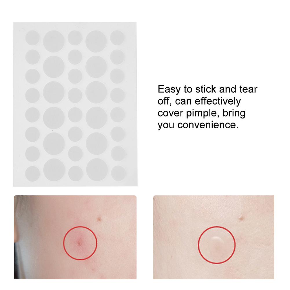 36pcs/sheet Transparent Hydrocolloid Pimple Patch Pimple Covering Concealing Sticker Patch