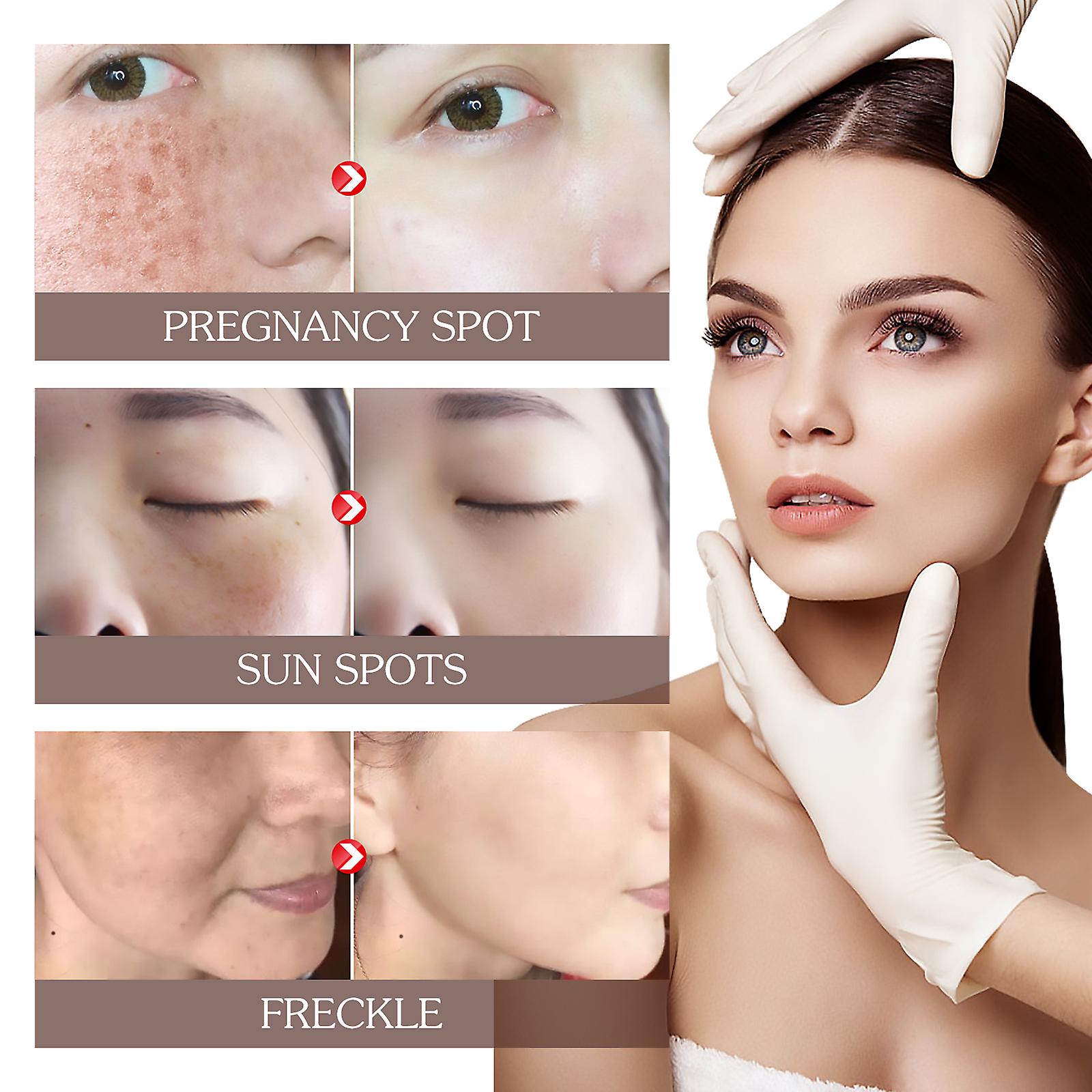 Peel Mask Brightening Mask: Spot Removal Melasma Dark Spots Hydration Moisture And Firmness