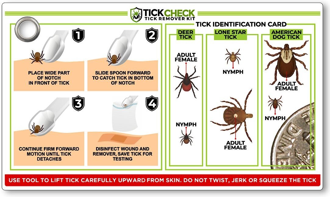 TickCheck Remover Spoon with Tick ID Card， 3-pack