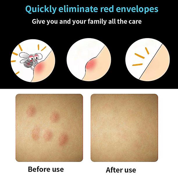 Insect Bite Healer Relief Pens， Bug Bites And Bee Wasp Stings Natural Bug Bites Relief Chemical Free Itch Stopper， Adjustable Anti Mosquito Antiprurit