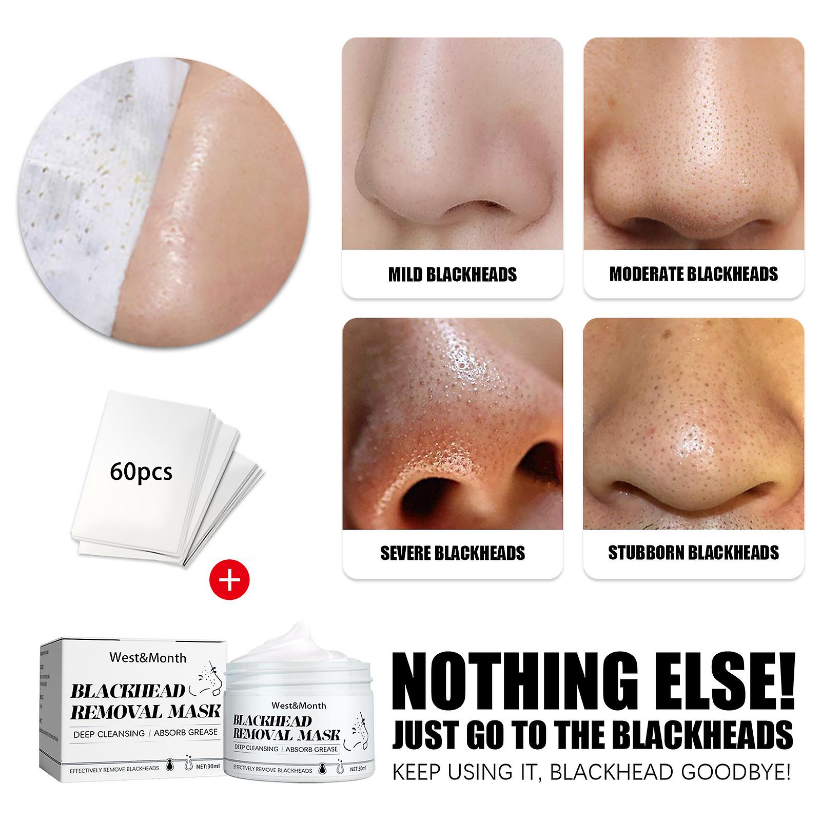 Peelable Blackheads Nasal Membrane T-zone Care Acne Removal Blackheads Shrinkage Pores Nasal Patches