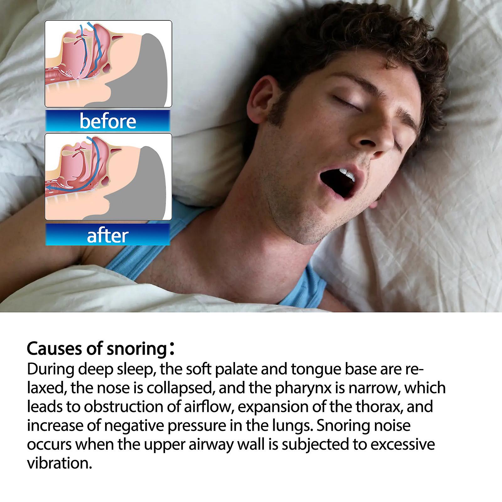 Anti-snoring Sticker Sleep Acupuncture Point Anti-snoring Belly Button Patch Prevent Fatigue Snoring And Stop Snoring