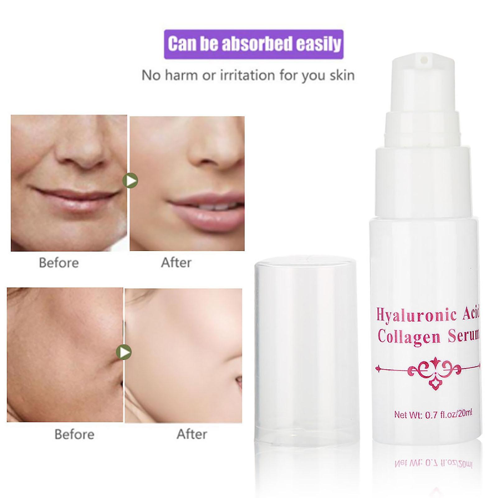 20ml Hyaluronic Acid Moisturizing Skin Repair Serum Collagen Anti Aging Anti Wrinkle Essence