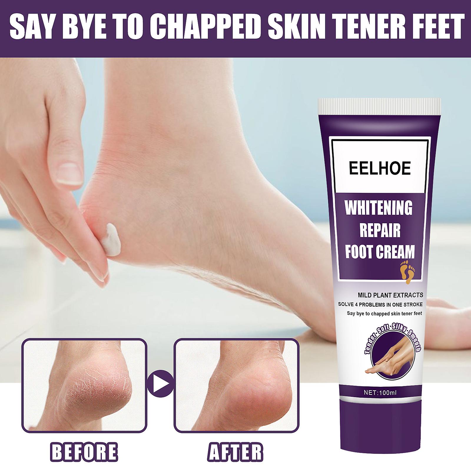 Whitening Repair Foot Cream Moisturizing Moisturizing Exfoliation