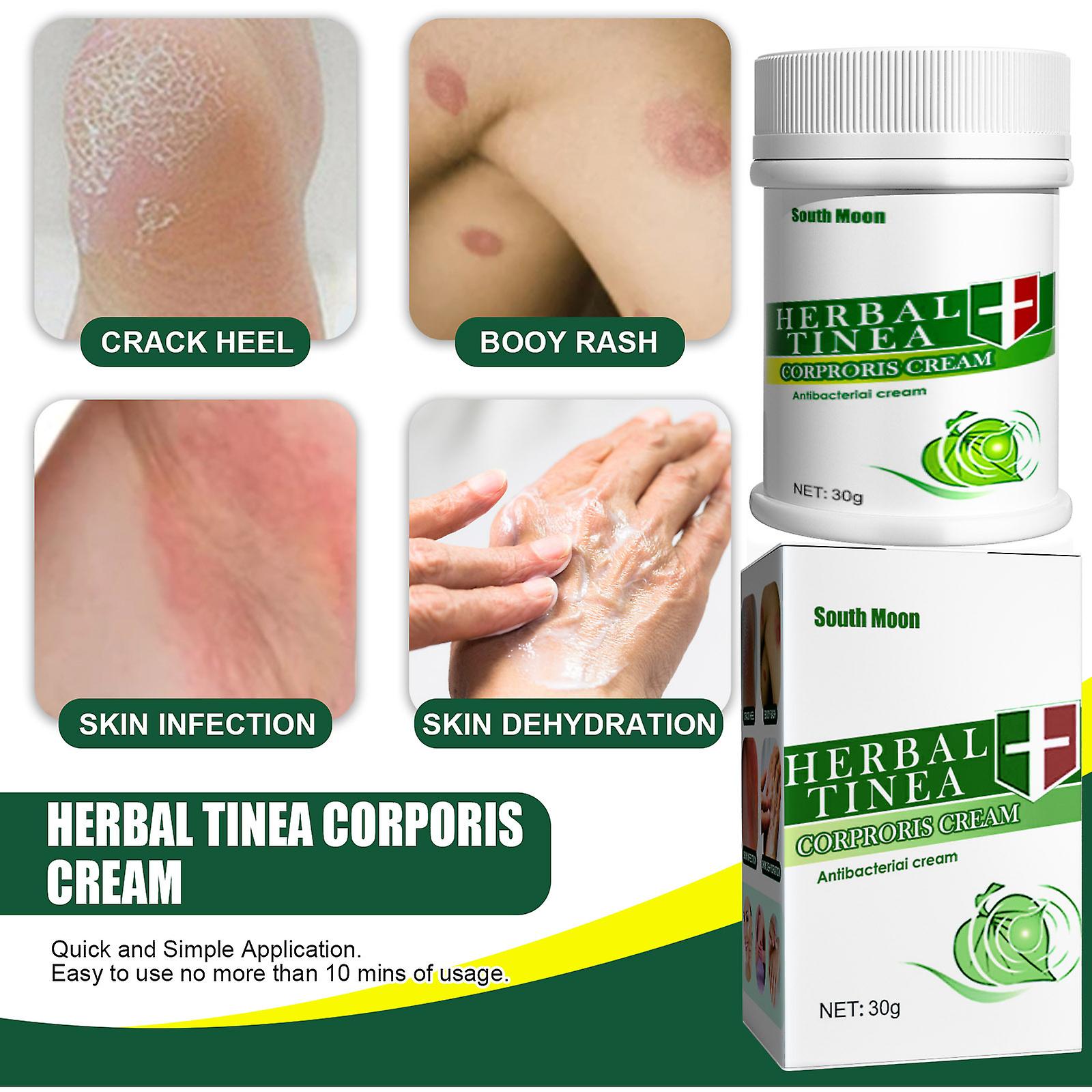 Herbal Skin Anti-itch Ointment Body External Ointment Mild Non-irritating Anti-pruritus Ointment