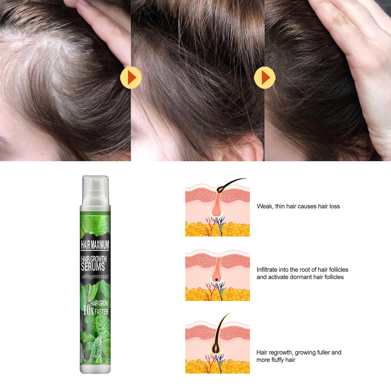 Peppermint Long Hair Mist， Moisturizing， Hydrating， Strengthening Hair， Nourishing Scalp Lotion Net Weight 10ml 1pcs (box)