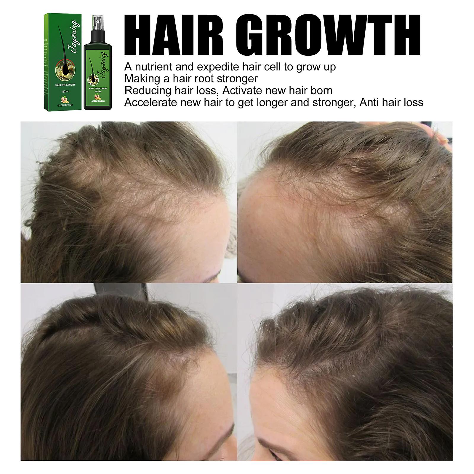 Hair Growth Solution: Strong Hair Nourishing Hair Roots Thick Scalp Massage Nutrient Solution